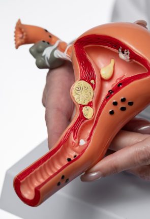 hand-holding-uterus-ovary-model